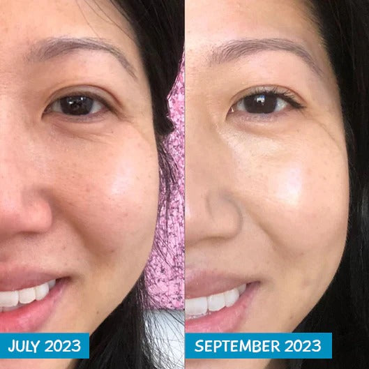 Prírodné sérum s botoxovým efektom