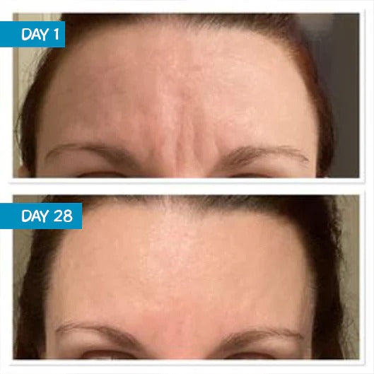 Prírodné sérum s botoxovým efektom